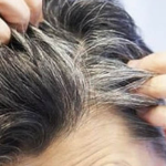 Kenali Fakta Unik Uban yang Tumbuh di Rambut Kepala