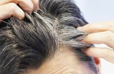 Kenali Fakta Unik Uban yang Tumbuh di Rambut Kepala